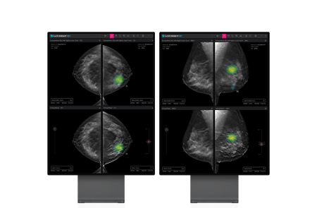 루닛, 국내 최초 3D AI 유방암 진단솔루션 “식약처 승인”