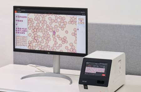 노을, 서아프리카 가나와 100만달러 규모 ‘AI 말라리아 진단 솔루션’ 공급 계약 체결