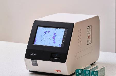 노을, 필리핀서 AI 기반 자궁경부암 진단 솔루션 승인