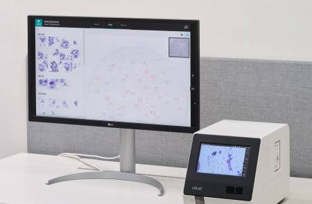 노을, 파나마 주요 의료기관에 11억원 규모 자궁경부암 AI 진단 솔루션 공급