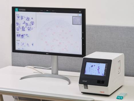 노을, CES 2026 참가 AI 자궁경부암 진단 솔루션 북미 시장 “첫 공개”