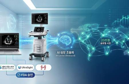 셀바스헬스케어, 美 FDA J&J 합작사 울트라사이트 추가 승인…모든 초음파 기기에 AI 탑재 확대