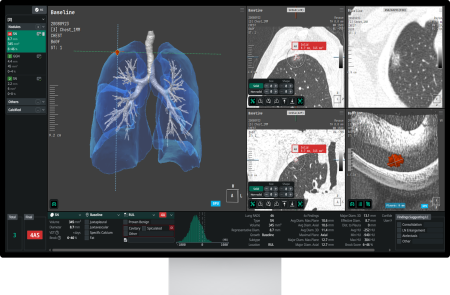 코어라인, 호주시장 레퍼런스 확대 “구조적 성장 진입”