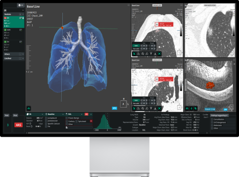 코어라인, 호주시장 레퍼런스 확대 “구조적 성장 진입”
