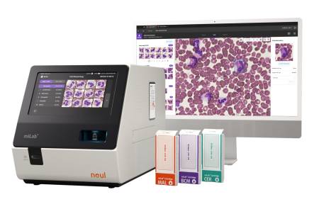 노을, 캐리비안 20여개국에 AI 진단 플랫폼 'miLab™' 공급… 중남미 시장 공략