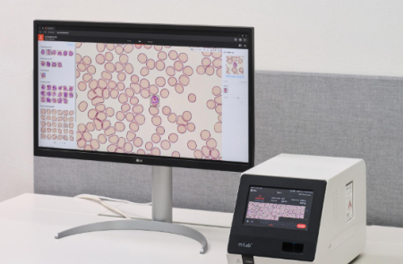 노을, 우간다에 AI 진단 장비 '마이랩' 100대 공급 "아프리카 시장 공략 가속"