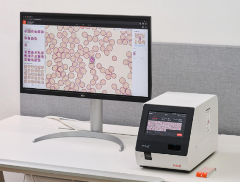 노을, 우간다에 AI 진단 장비 '마이랩' 100대 공급 "아프리카 시장 공략 가속"
