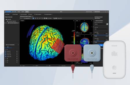 뉴로핏, 국내 의료기관 10곳에 '개인 맞춤형 tDCS 솔루션' 공급 "10월 비급여 적용"